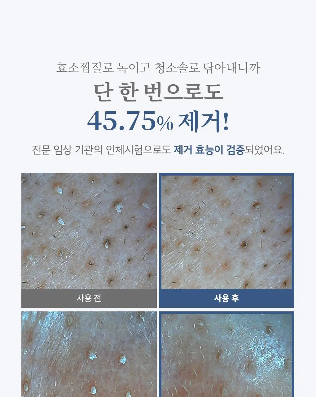 [블랙헤드관리/김다혜PICK] 비프로젝트 바이 블랙헤드 멜팅 리무버 30ml 상세페이지 39